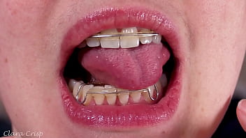 Tempting you into cumming on my retainers bbw milf mouth