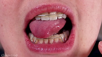 Tempting you into cumming on my retainers bbw milf mouth