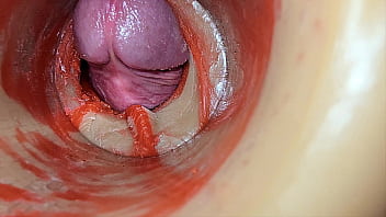 Female insemination internal camera captures deep male huge ejaculation
