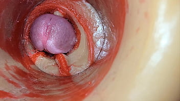 Female insemination internal camera captures deep male huge ejaculation