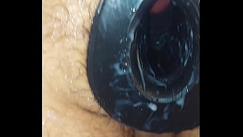 Фистят открытый анус