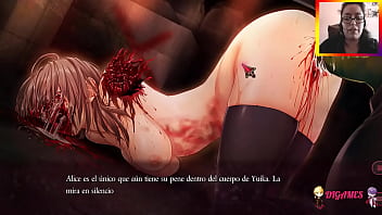 Sdisticb parte seiss