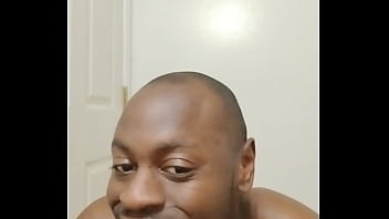 I had another chance to keep growing facial hair out and this happened for free are followers okay when this happens 1