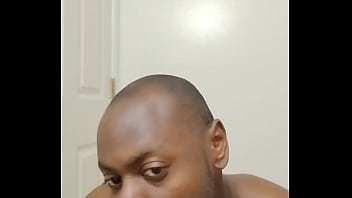 I had another chance to keep growing facial hair out and this happened for free are followers okay when this happens 1