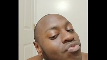 I had another chance to keep growing facial hair out and this happened for free are followers okay when this happens 1