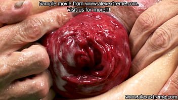 Irina faust fisting prolapse 2025 extreme pierced pussy and ruined ass Irina faust fisting prolapse 2025 extreme pierced pussy and ruined ass