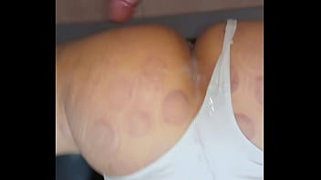 The physiotherapy consultation ends when the doctor ejaculates on the patients' buttocks