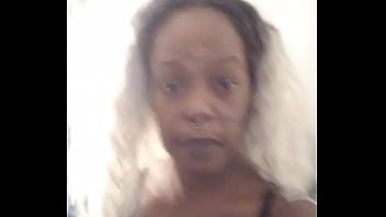 Unsupported topical creams faq