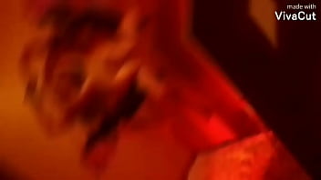 Anal wide gapping sling