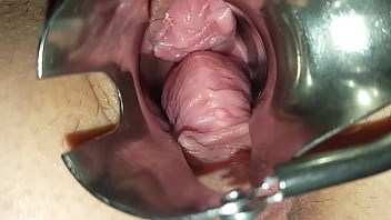 Gaping Slut thumbnail