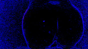 Amateur couple weird lighting