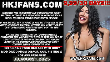 Hkj dildo anal fisting prolapse 30 08 2025