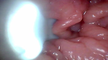 First an endoscope reveals the g spot up close – without mounting First an endoscope reveals the g spot up close – without mounting