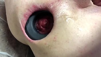 Extreme Anal Gaping 1 thumbnail