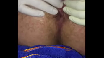 6cm Plug Play With Small First Time Prolapse thumbnail