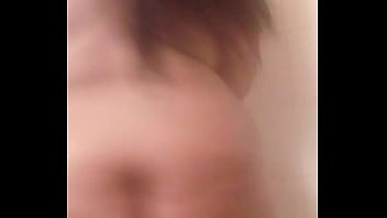 Cosmetic surgery free