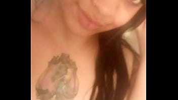 Cosmetic surgery free