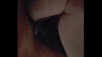 Blue rope swollen lips