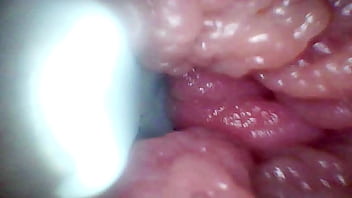 Endoscope camera records my wife's g spot educational video