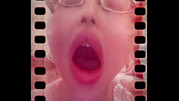 I can not close my mouth from hardly deep yawning I can not close my mouth from hardly deep yawning
