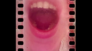 I can not close my mouth from hardly deep yawning I can not close my mouth from hardly deep yawning