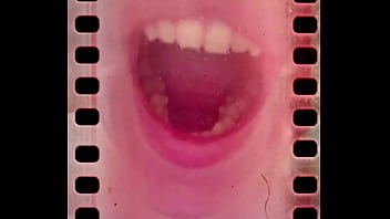 I can not close my mouth from hardly deep yawning I can not close my mouth from hardly deep yawning