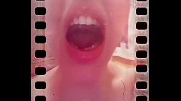 I can not close my mouth from hardly deep yawning