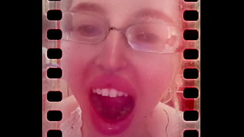 I can not close my mouth from hardly deep yawning I can not close my mouth from hardly deep yawning