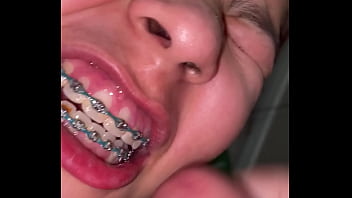 Braces cumshot dirty teeth