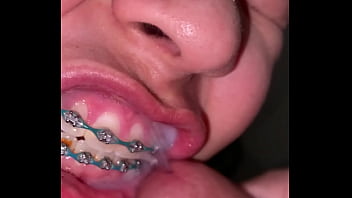Braces cumshot dirty teeth