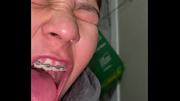Braces cumshot dirty teeth Braces cumshot dirty teeth