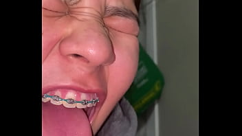 Braces cumshot dirty teeth