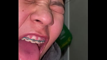 Braces cumshot dirty teeth