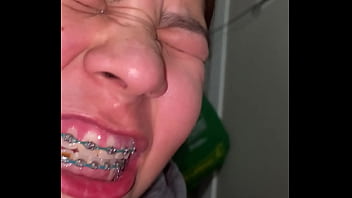 Braces cumshot dirty teeth