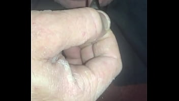 Sounding Dialation Pee Hole thumbnail