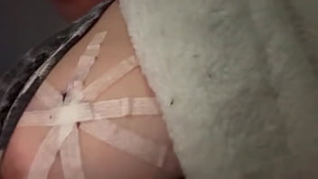 Just Realized It’s Been Over A Year Since My Breast Cancer Scare And My Cool To Watch Boob Biopsy thumbnail