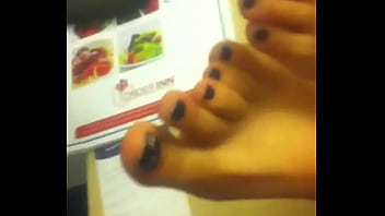 Miss black toenails