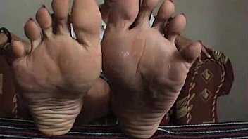 627799 Wide Toe Spreading Amp Long Toe Nails thumbnail