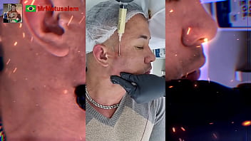 Motivação me transformei com a harmonização facial veja o resultado