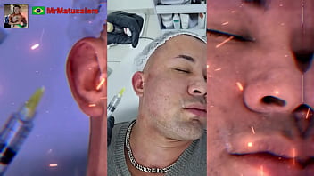 Motivação me transformei com a harmonização facial veja o resultado