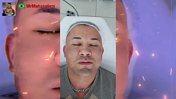 Motivação me transformei com a harmonização facial veja o resultado