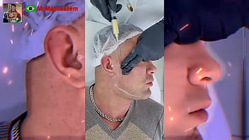 Motivação me transformei com a harmonização facial veja o resultado