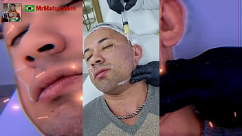 Motivação me transformei com a harmonização facial veja o resultado