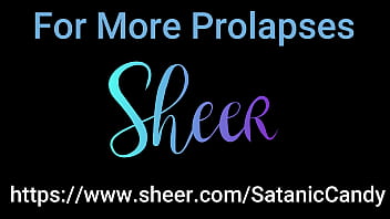 Anal overload blowjob gapes atm atp & prolapse creampie