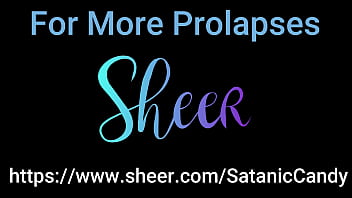 Anal overload blowjob gapes atm atp & prolapse creampie Anal overload blowjob gapes atm atp & prolapse creampie