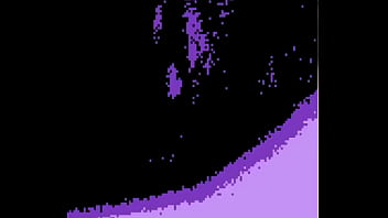 Limpieza Oral Profunda thumbnail