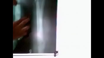 Asudevi Bisnoi thumbnail