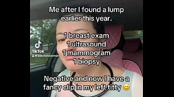 Ohso i never said anything on any platform until a few weeks ago on tt#boobs #breastcancer