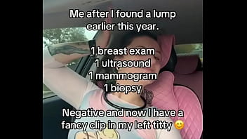 Ohso i never said anything on any platform until a few weeks ago on tt#boobs #breastcancer