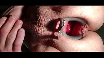 Medical Gape thumbnail
